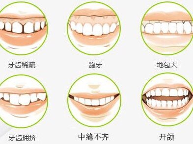 导致孩子牙牙畸形的3个习惯,你家宝宝有几种?