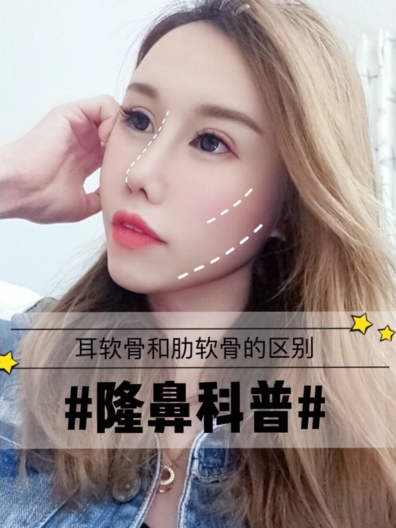 【隆鼻科普】耳软骨和肋软骨隆鼻的区别