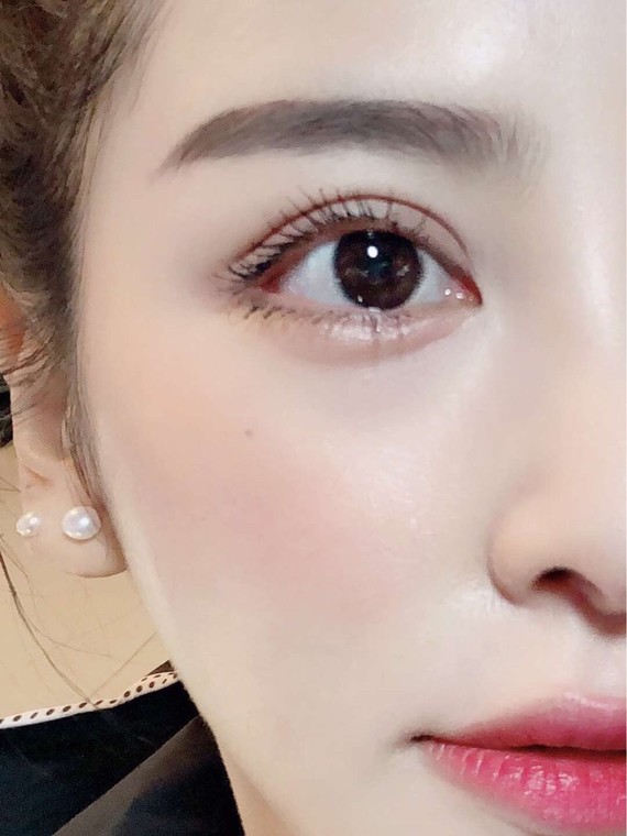 不能按照固有的模板完全复制同样的双眼皮在脸上,应该综合我们自己的