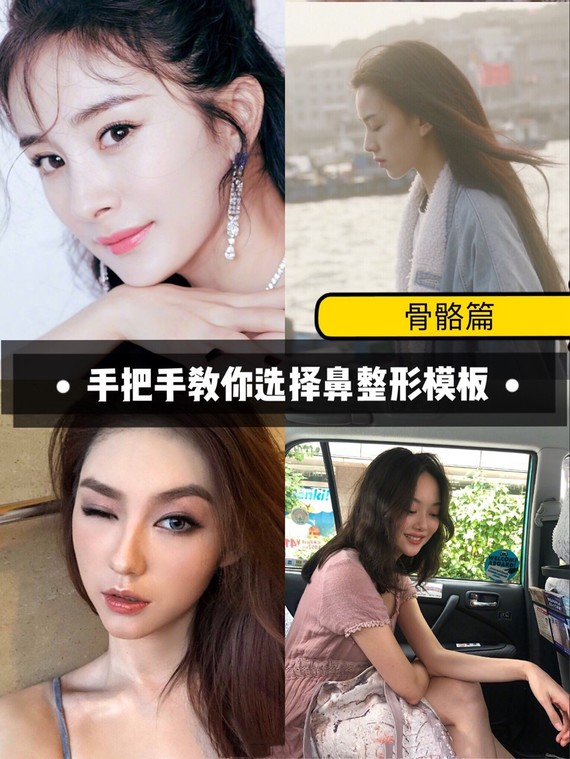 手把手教你选择鼻整形模板(骨骼篇#美商提高78面部_圈子-新氧美容