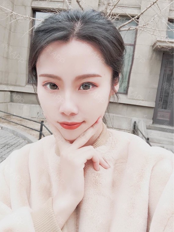 探店华山,特价做了双眼皮,还完美保留了我的狐狸眼
