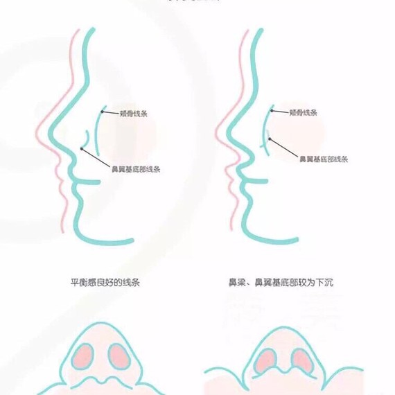 面部最容易忽视的小细节—鼻基底大揭秘
