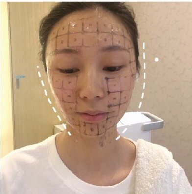 热玛吉