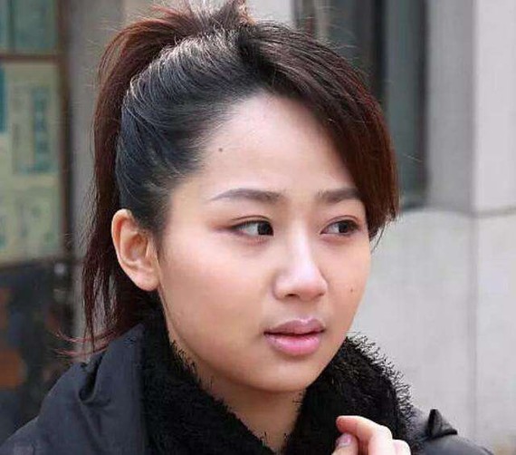 杨紫的脸为什么会突然崩了?是整形后遗症吗