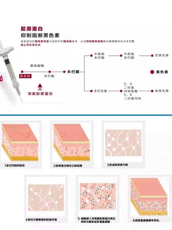 9191玻尿酸和胶原蛋白两种都是注射填充材料,很多