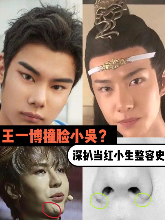 王一博撞脸小吴?