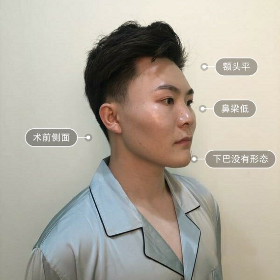 很多人会认为,一旦整 形与男性关联上,就会自动生成"娘 炮","女性化"