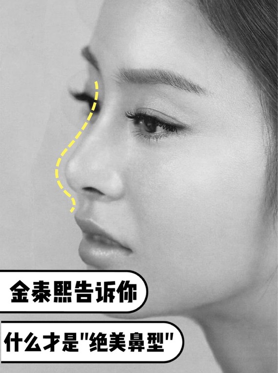 95韩国第一美女用"绝美鼻型"告诉你明星和网红的