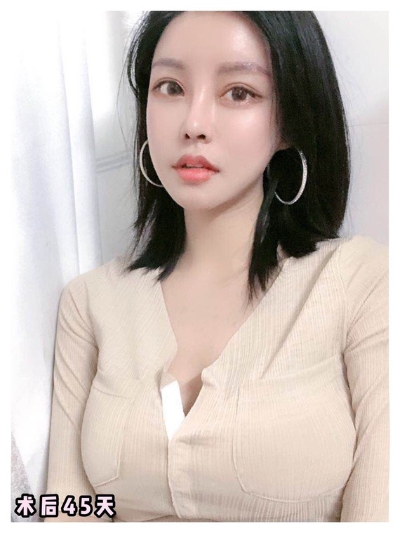 少女酥胸变大妈胸!胸部下垂怎么办?