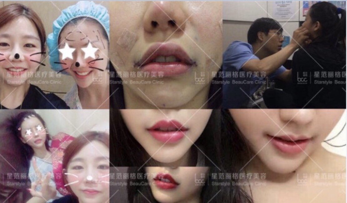 上次发了 #微笑m唇# 效果对比后陆续有求美者私信