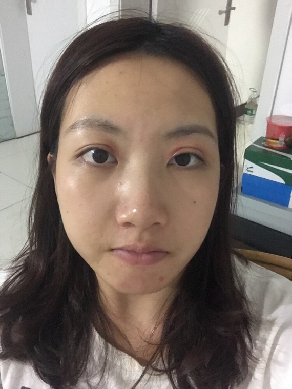 要整哪里我这个五官好不协调还是脸型问题