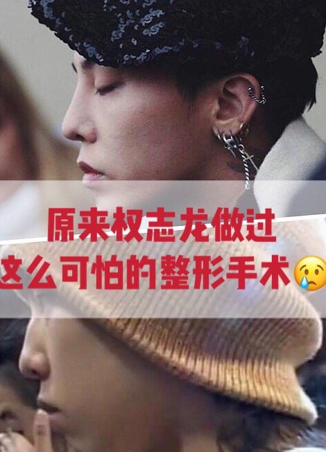 即将退伍,他的脸又上风口浪尖7515权志龙离退伍只剩短_圈子-新氧