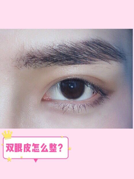 那有什么标准来衡量双眼皮呢?可以说是"睁眼有神,闭眼无痕"来形容.