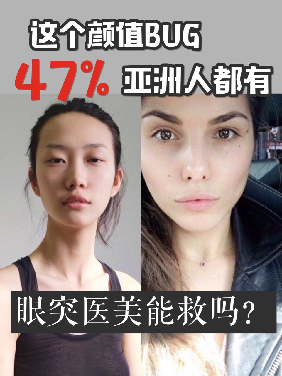 深邃的眼睛会显得五官更加立体,但是亚洲人有一个47%都有的颜值bug就