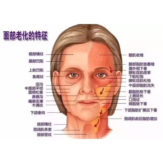 自体脂肪面部填充,如何对抗初老?