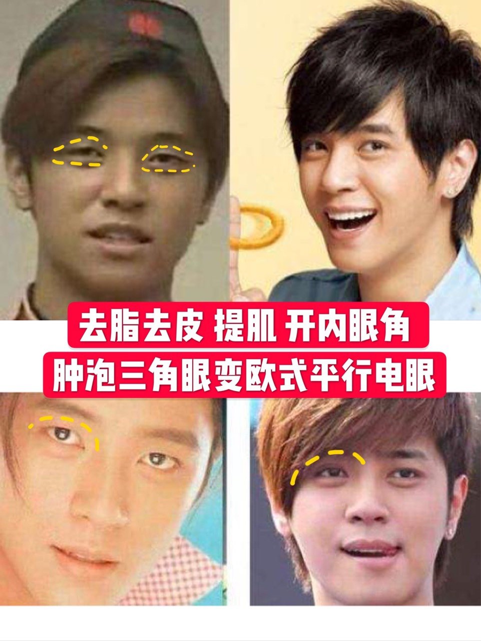 双眼皮也是男明星标配吗?眼睛对颜值的影响到底有多大?