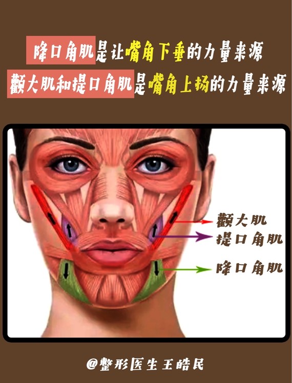 硬核知识贴嘴角上扬肌肉折叠手术00