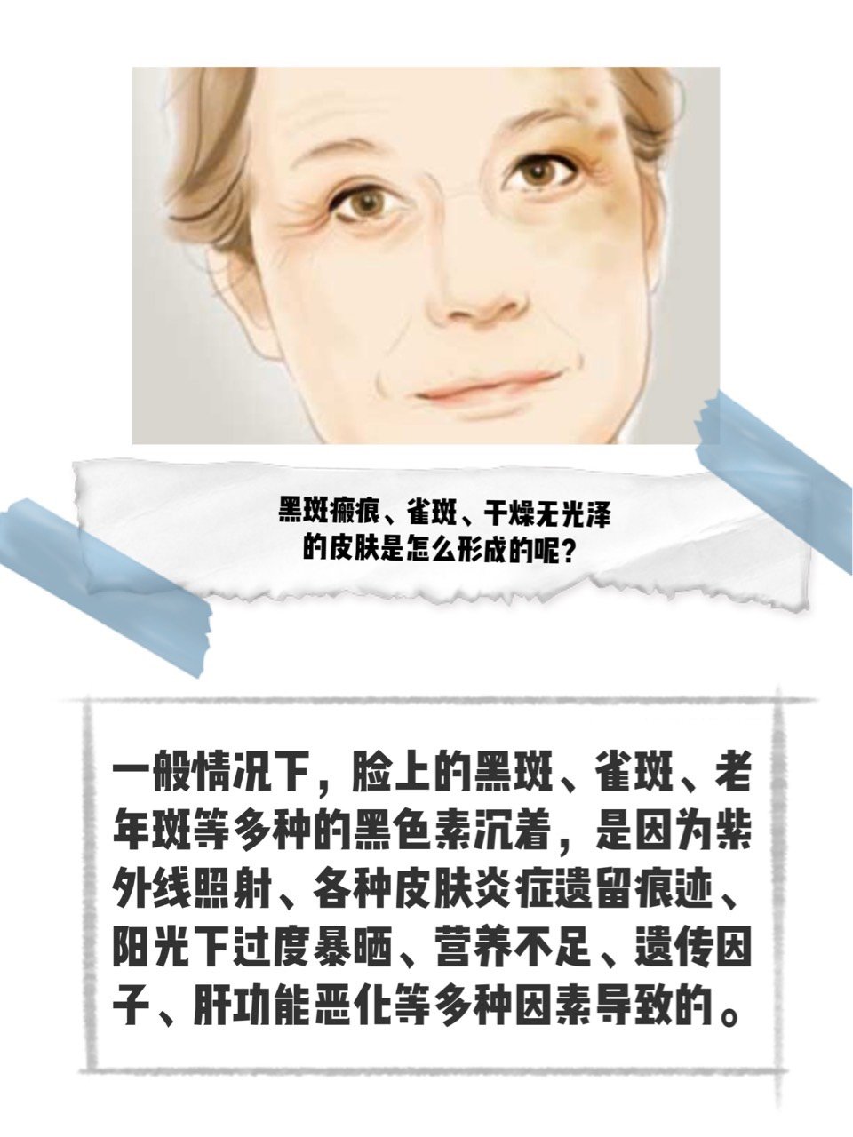 不管你是哪一种斑统统说拜拜