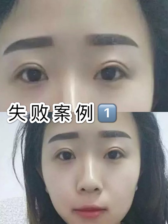 裸妆心机干货90半永久纹眉如何避免失败纹眉———