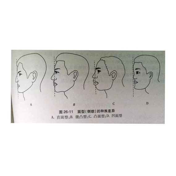 的面部根据区域的不同分为直面型,微凸面型,凸面型以及凹面型(图2)