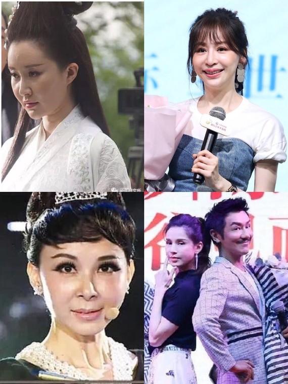 但是很多人包括明星在面部填充时都会翻车～到底为什么呢?