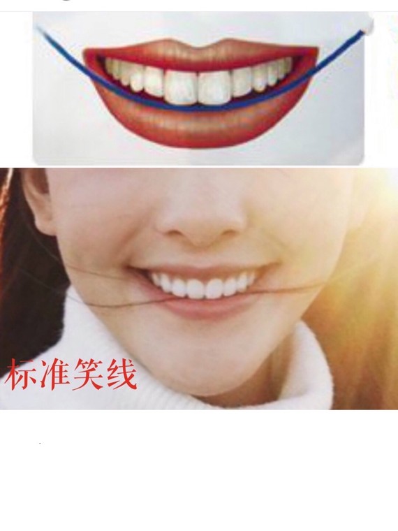 0299♀15牙齿微笑线的秘密0299♀1599牙齿微笑线,简称