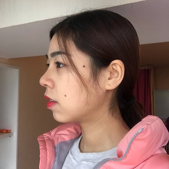 我想知道我这属于直鼻还是翘鼻