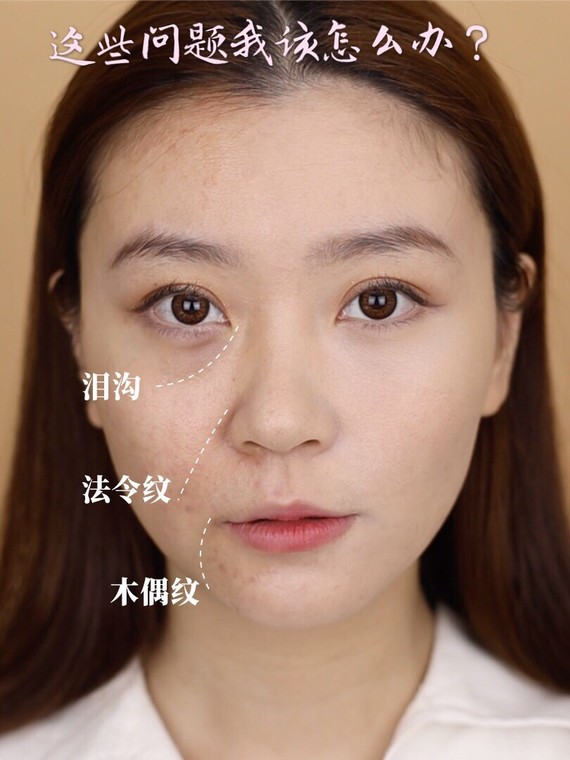 注射除木偶纹