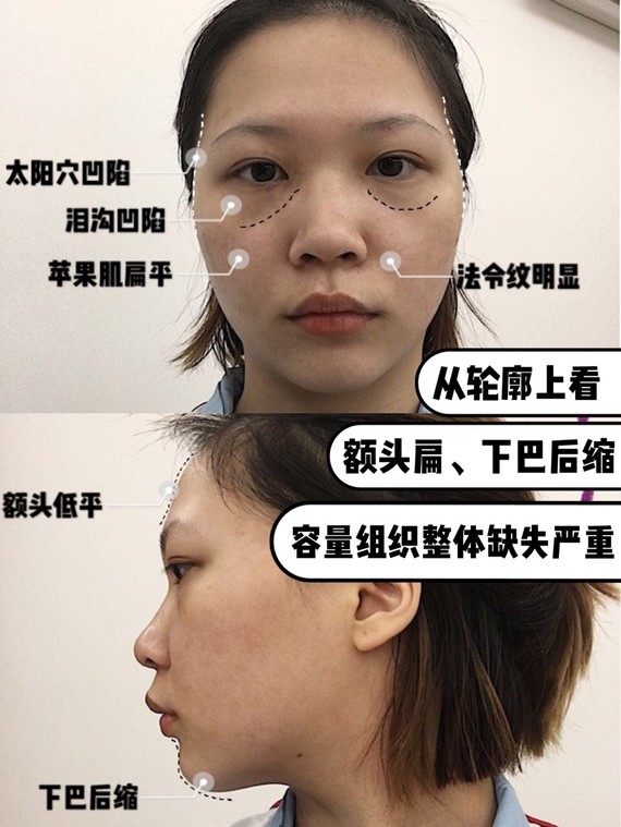 教你五官分散平均脸如何更具"辨识度,美出自我风格