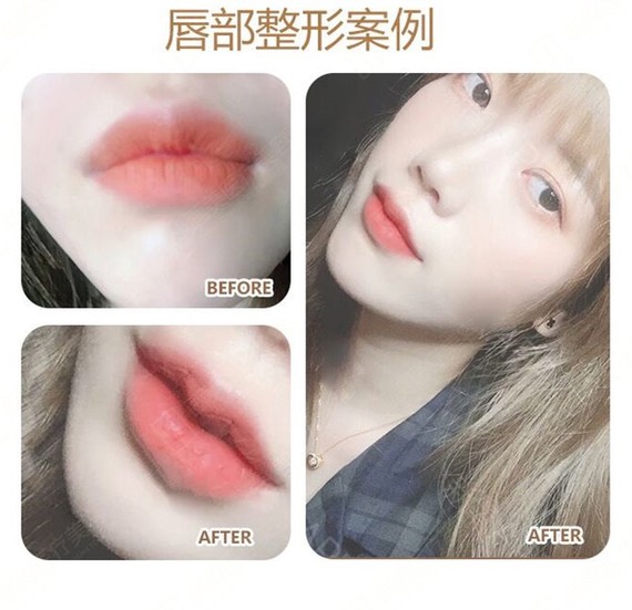有人迷恋性感厚唇,也有人偏爱传统的樱桃小嘴,也有人对m型唇情有独钟