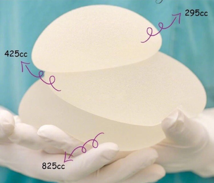 不同尺寸的隆胸假体在手上的大小.一般400cc就能_圈子