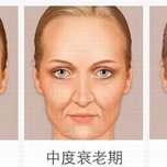 面部衰老的变化及应对的方法,你知道吗?