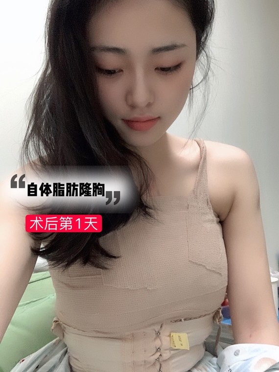 自体脂肪隆胸,术后出现硬块怎么处理?