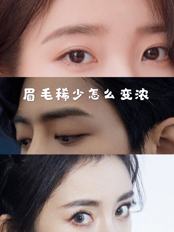 眉毛稀少怎么变浓7878眉毛眉淡且稀少怎么办,很多
