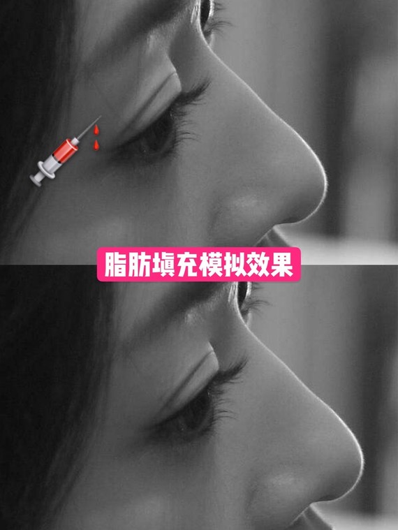 被叫金鱼眼可能哪个女生都不爱听,这种眼睛显得人很凶,还容易有大眼无