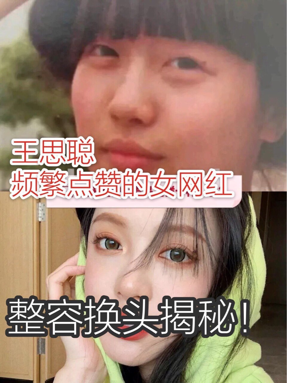 王思聪念念不忘的女网红—彭王者的整容换头揭秘 _圈子-新氧美容整形