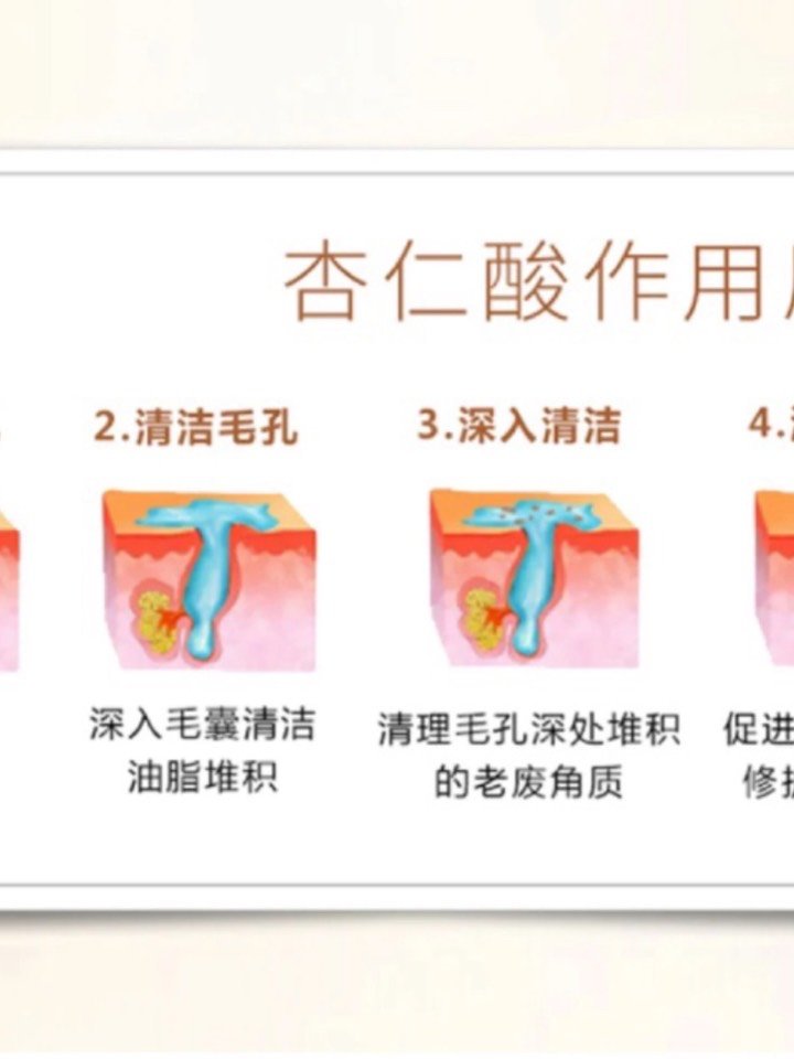 关于刷酸的个人心得99999999我现在的皮肤状态还算可以_圈子