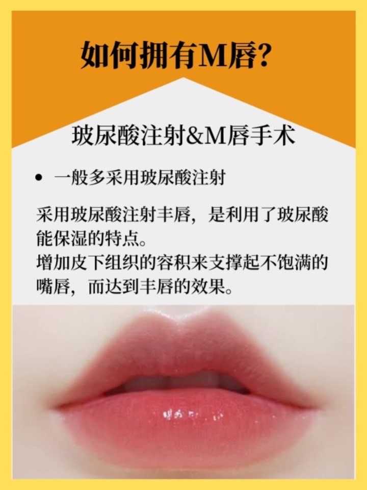 m唇