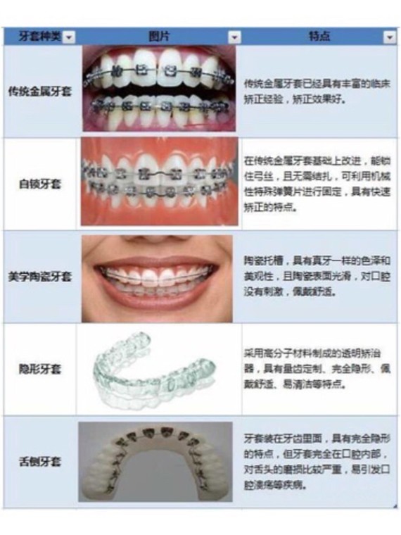 牙套的种类上一篇我们有聊过牙齿矫正对脸型的影响
