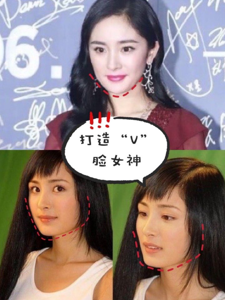 751575157515杨幂"方脸"变"v脸,越来越有女神范_圈子