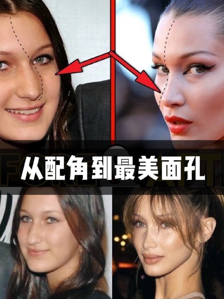 bellahadid整容,bellahadidgigi de silva根据希腊黄金分割理论研究显示,超模bella hadid的面孔完美度