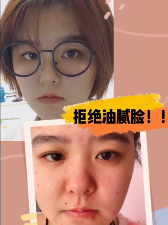 【所长追7615话题】拒绝油腻脸!夏天就是要清清