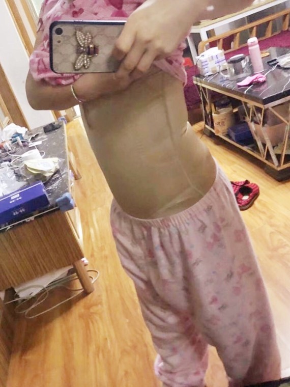 【手术医院】:宝士丽整形医院