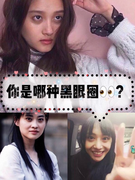 的问题是越来越普遍,娱乐圈的明星们由于工作性质,经常也是作息不规律