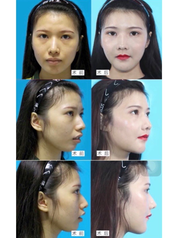 凸嘴大改造,原始人变身小仙女
