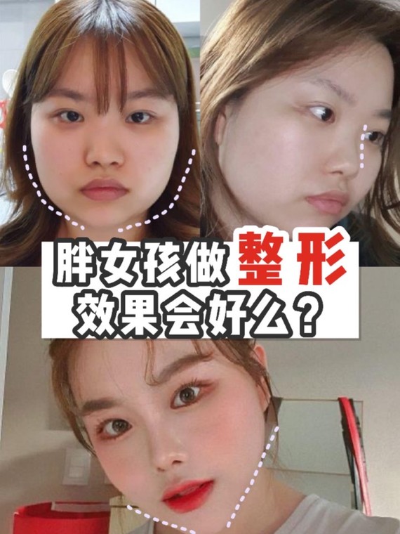 整形的话比较难确定五官改变多少,比如鼻子设计多高以至于瘦下来不