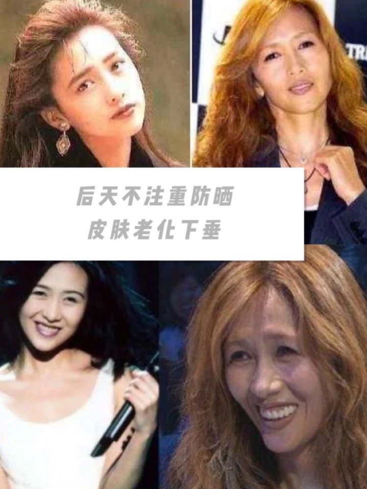 工藤静香衰老原因是后天不注重防晒 皮肤老化下垂