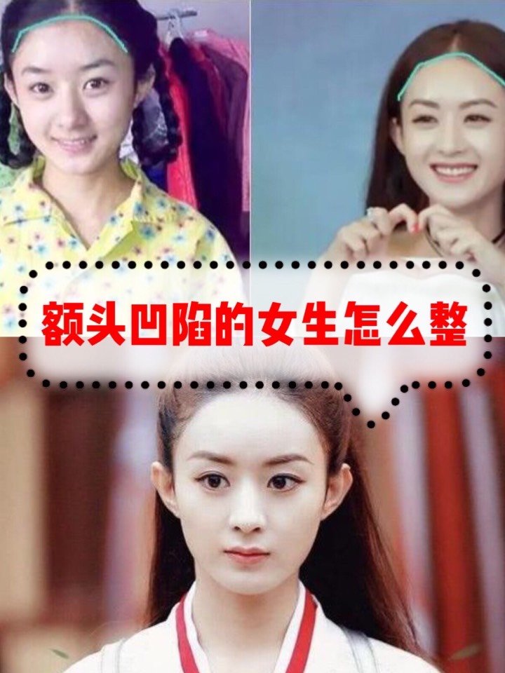 额头窄低,整个人的形象就不好,别人对自己的印象也不会好,因而对自己