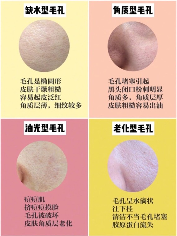 医美如何收缩毛孔拯救毛孔粗大