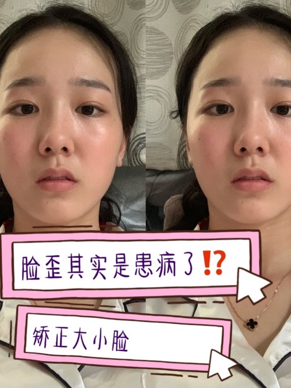 脸歪,大小脸71你可能是患病了7501最近羊羊发现